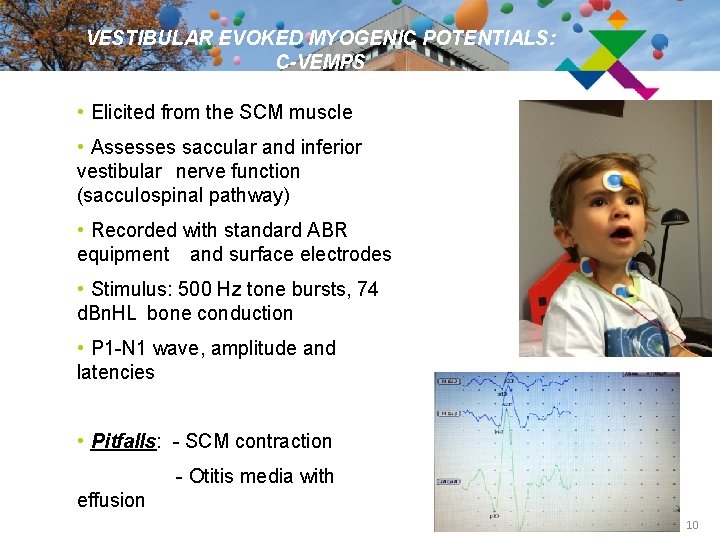 VESTIBULAR EVOKED MYOGENIC POTENTIALS: C-VEMPS • Elicited from the SCM muscle • Assesses saccular