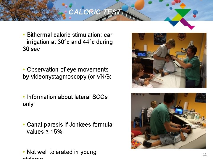 CALORIC TEST • Bithermal caloric stimulation: ear irrigation at 30°c and 44°c during 30