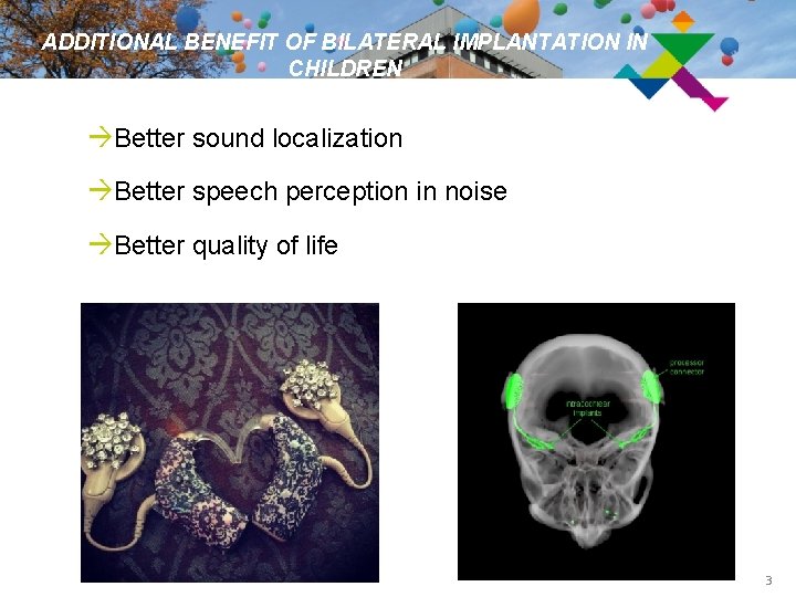 ADDITIONAL BENEFIT OF BILATERAL IMPLANTATION IN CHILDREN àBetter sound localization àBetter speech perception in