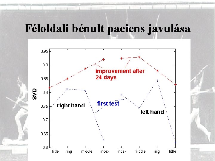 Féloldali bénult paciens javulása 