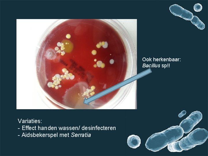 Ook herkenbaar: Bacillus sp!! Variaties: - Effect handen wassen/ desinfecteren - Aidsbekerspel met Serratia