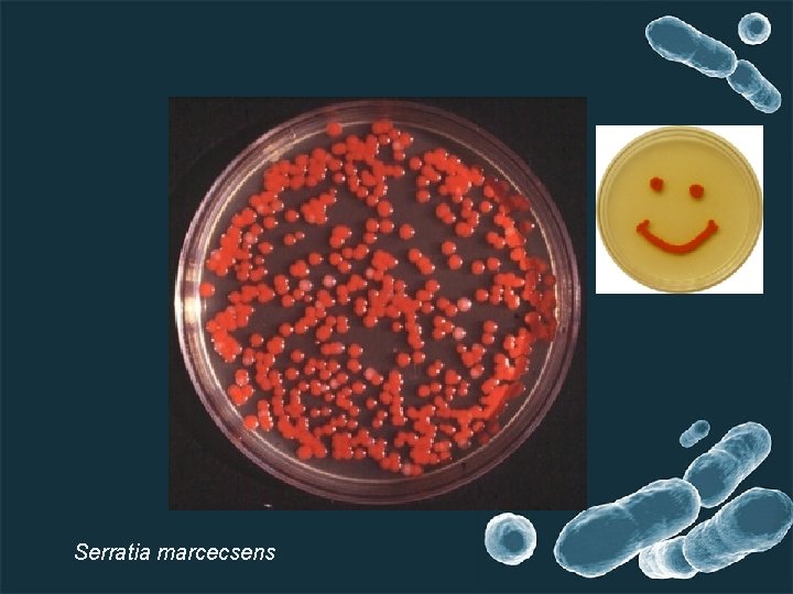 Serratia marcecsens 