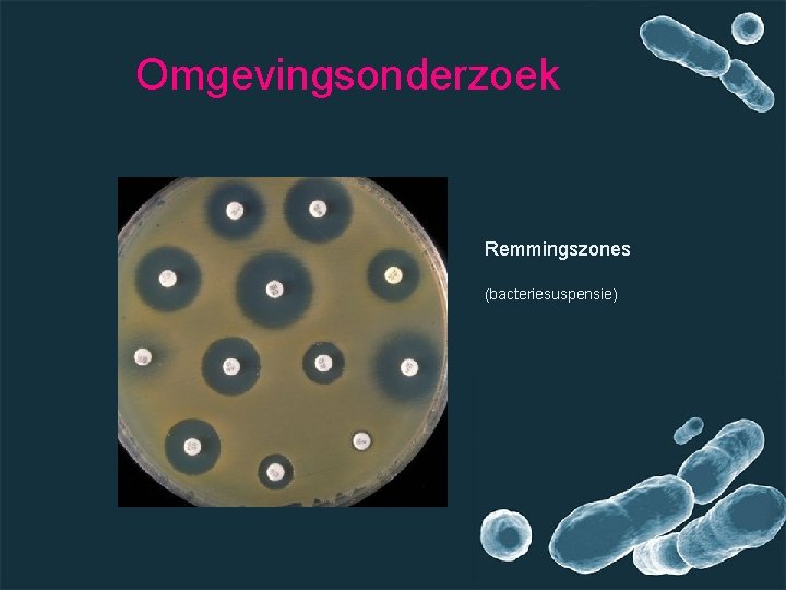 Omgevingsonderzoek Remmingszones (bacteriesuspensie) 