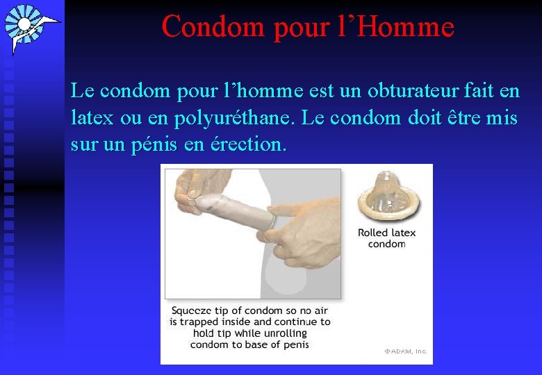  Condom pour l’Homme Le condom pour l’homme est un obturateur fait en latex