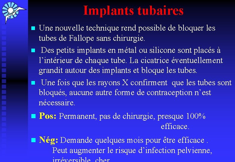 Implants tubaires n n Une nouvelle technique rend possible de bloquer les tubes de