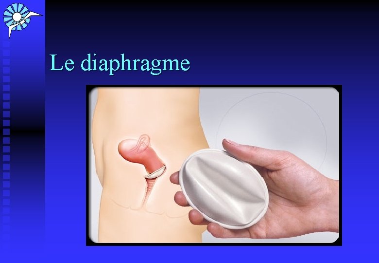 Le diaphragme 