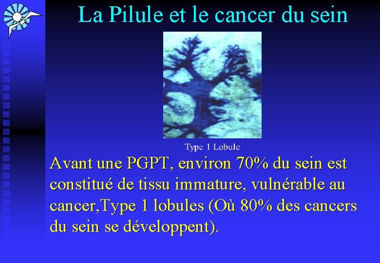 La Pilule et le cancer du sein Avant une PGPT, environ 70% du sein