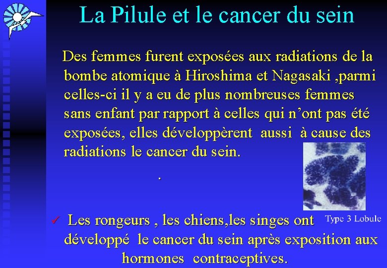 La Pilule et le cancer du sein Des femmes furent exposées aux radiations de