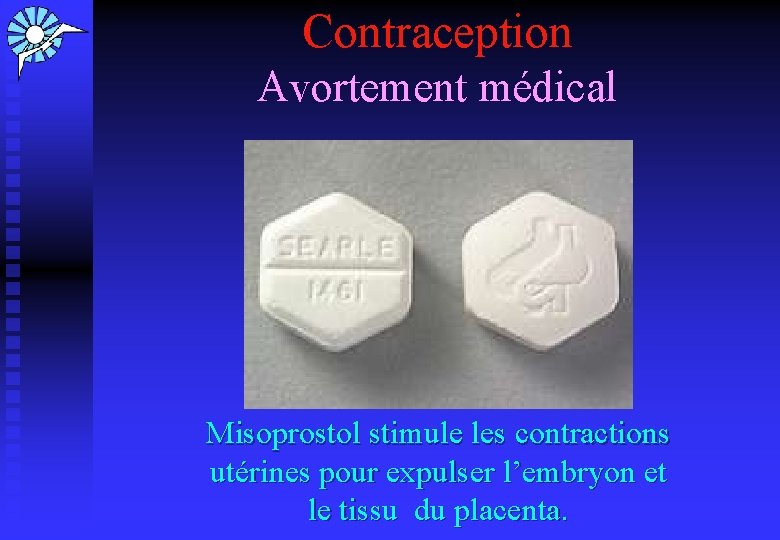 Contraception Avortement médical Misoprostol stimule les contractions utérines pour expulser l’embryon et le tissu