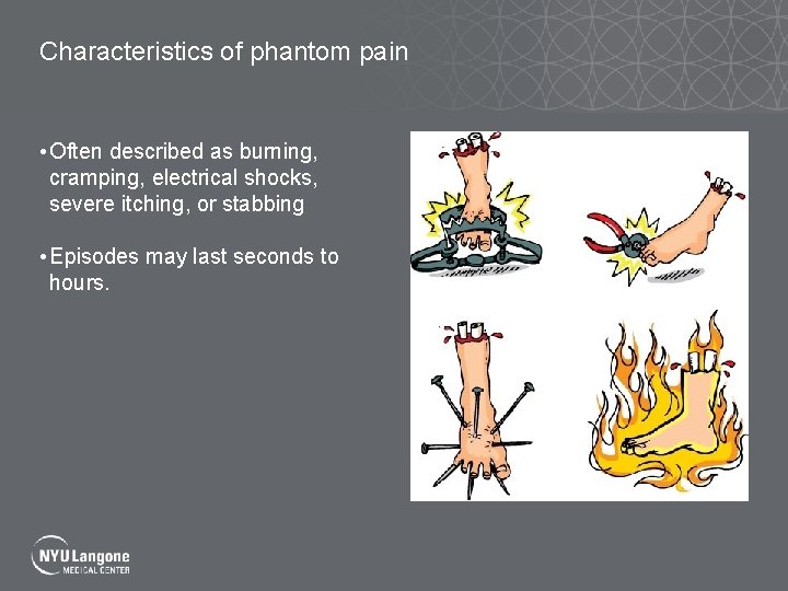 Characteristics of phantom pain • Often described as burning, cramping, electrical shocks, severe itching,