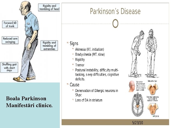 Boala Parkinson Manifestări clinice. 