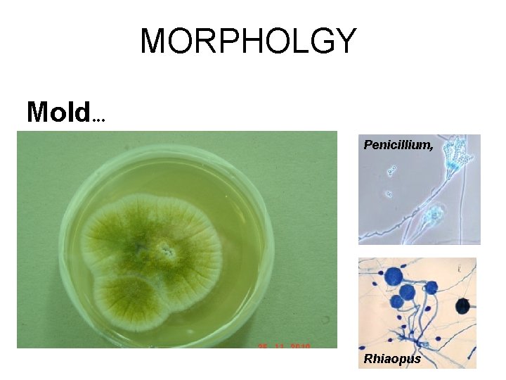 MORPHOLGY Mold. . . Colonial morphology Penicillium, Rhiaopus 