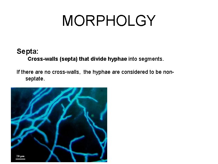 MORPHOLGY Septa: Cross-walls (septa) that divide hyphae into segments. If there are no cross-walls,