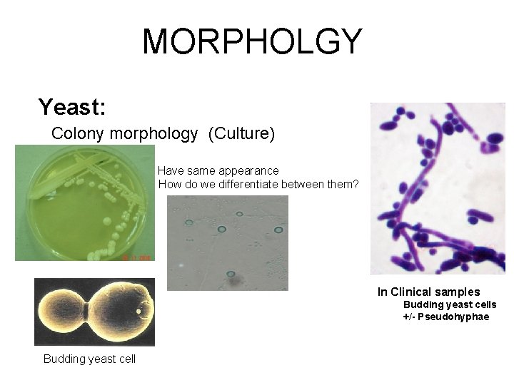 MORPHOLGY Yeast: Colony morphology (Culture) Have same appearance How do we differentiate between them?