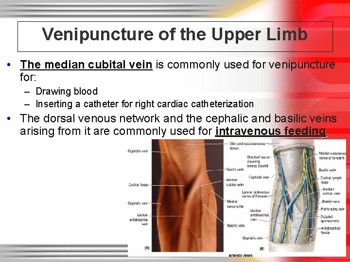 Venipuncture of the Upper Limb • The median cubital vein is commonly used for