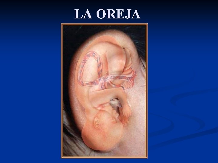 LA OREJA 