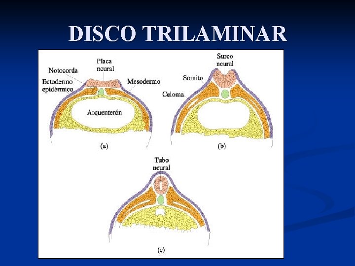 DISCO TRILAMINAR 