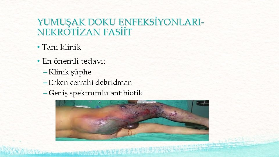 YUMUŞAK DOKU ENFEKSİYONLARINEKROTİZAN FASİİT • Tanı klinik • En önemli tedavi; – Klinik şüphe