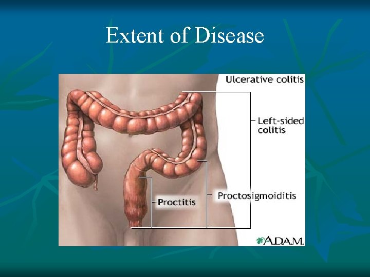 Extent of Disease 