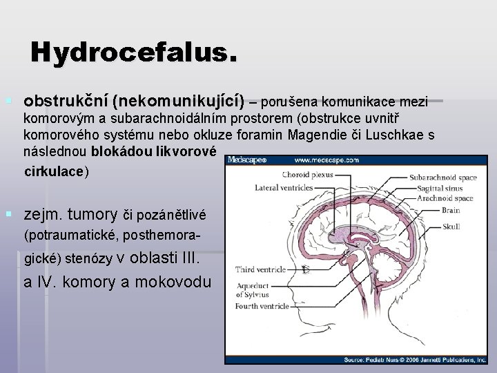 Hydrocefalus. § obstrukční (nekomunikující) – porušena komunikace mezi komorovým a subarachnoidálním prostorem (obstrukce uvnitř