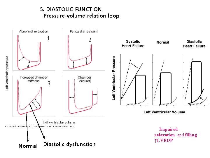 5. DIASTOLIC FUNCTION Pressure-volume relation loop Normal 1 2 3 4 Diastolic dysfunction Impaired
