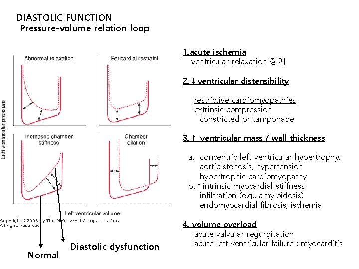 DIASTOLIC FUNCTION Pressure-volume relation loop 1. acute ischemia ventricular relaxation 장애 2. ↓ventricular distensibility