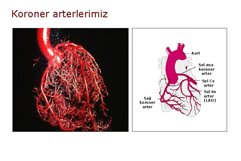 Koroner arterlerimiz Aort Sol ana koroner arter Sol Cx arter Sağ koroner arter Sol