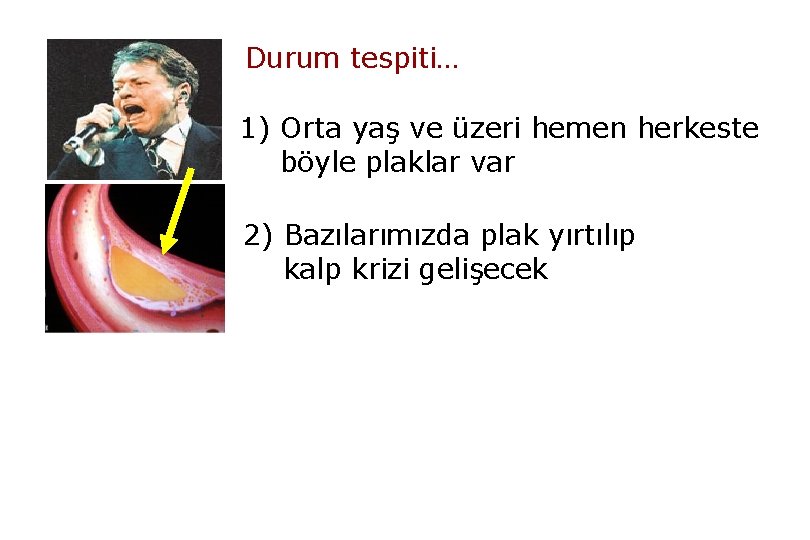 Durum tespiti… 1) Orta yaş ve üzeri hemen herkeste böyle plaklar var 2) Bazılarımızda