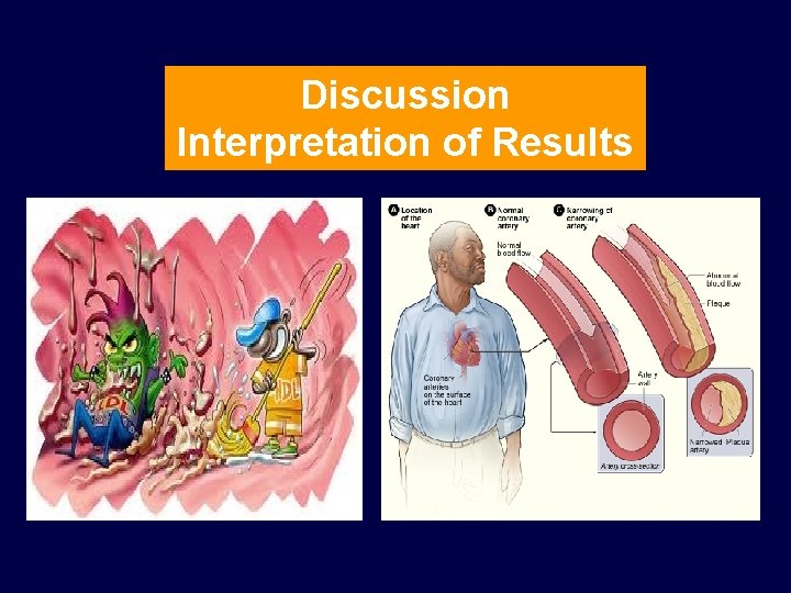 Discussion Interpretation of Results 