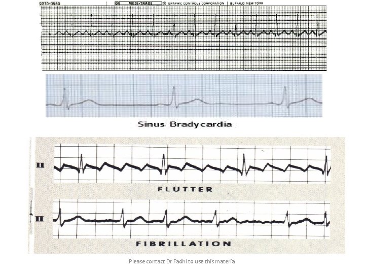 Please contact Dr Fadhl to use this material 