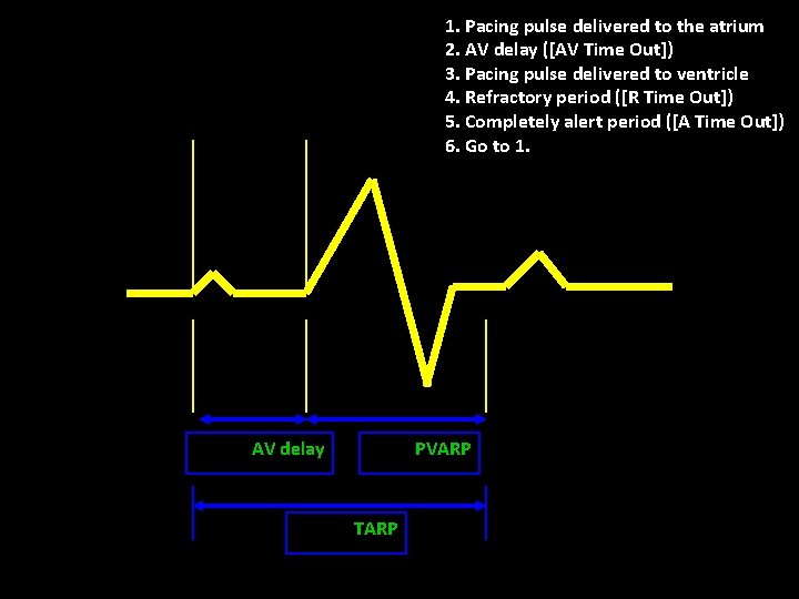 1. Pacing pulse delivered to the atrium 2. AV delay ([AV Time Out]) 3.