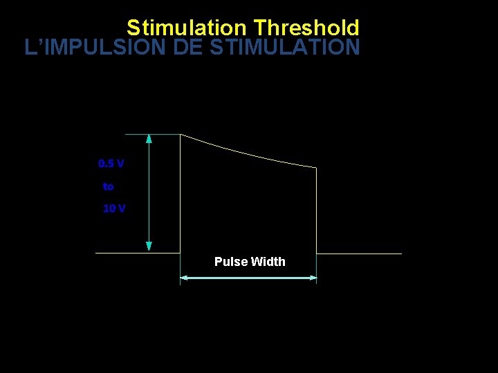 Stimulation Threshold L’IMPULSION DE STIMULATION 0. 5 V to 10 V Pulse Width 