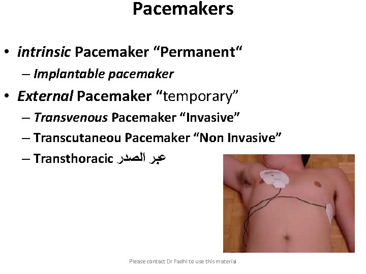 Pacemakers • intrinsic Pacemaker “Permanent“ – Implantable pacemaker • External Pacemaker “temporary” – Transvenous