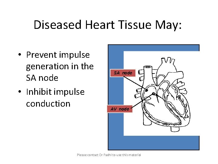 Diseased Heart Tissue May: • Prevent impulse generation in the SA node • Inhibit