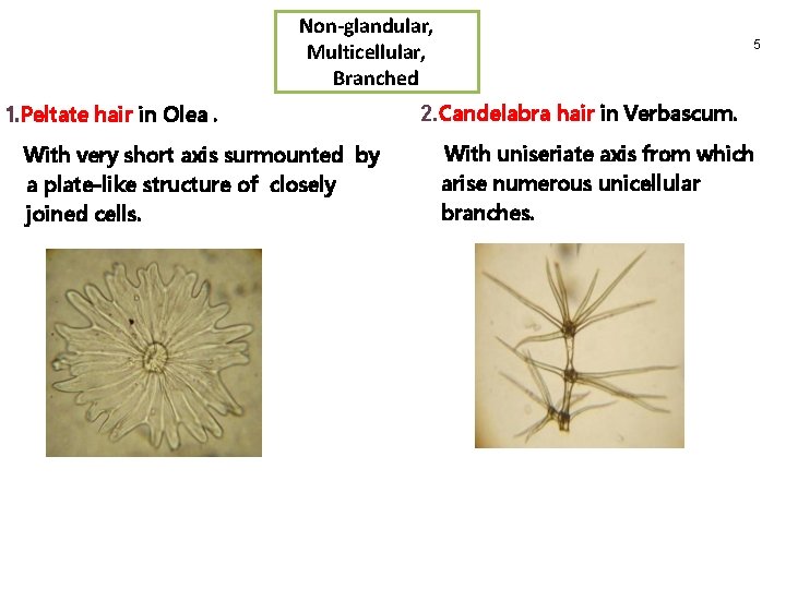 Non-glandular, Multicellular, Branched 1. Peltate hair in Olea. With very short axis surmounted by