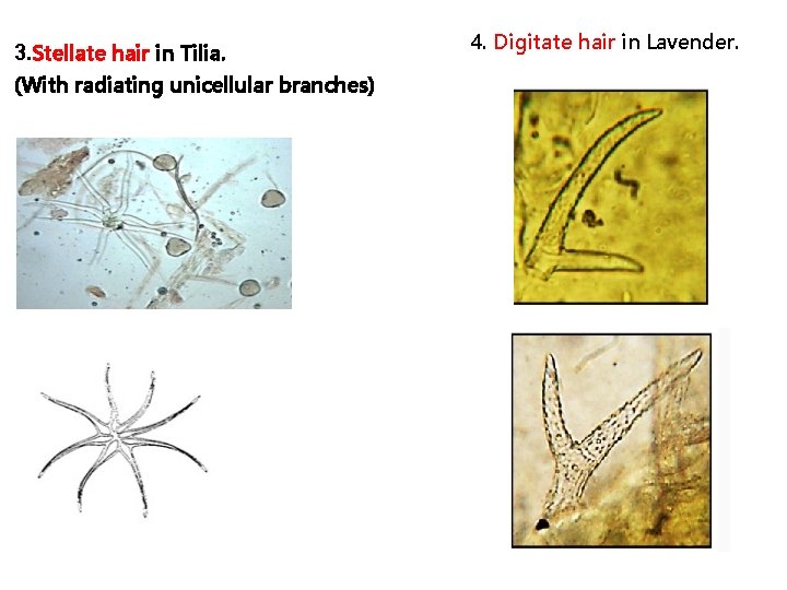 3. Stellate hair in Tilia. (With radiating unicellular branches) 4. Digitate hair in Lavender.