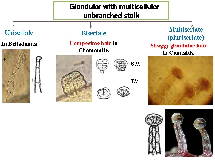 Glandular with multicellular unbranched stalk Uniseriate Biseriate In Belladonna Compositae hair in Chamomile. Multiseriate