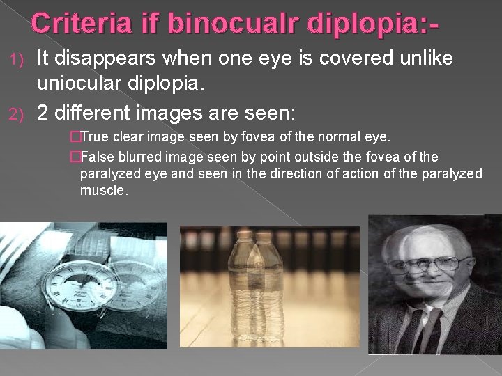 Criteria if binocualr diplopia: It disappears when one eye is covered unlike uniocular diplopia.