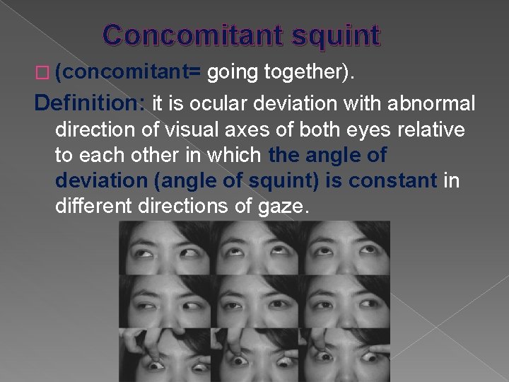 Concomitant squint � (concomitant= going together). Definition: it is ocular deviation with abnormal direction