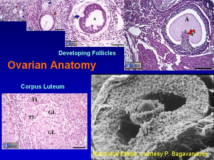 Ovarian Anatomy Developing Follicles Ovarian Anatomy Corpus Luteum Rat antral follicle, courtesy P. Bagavandoss.