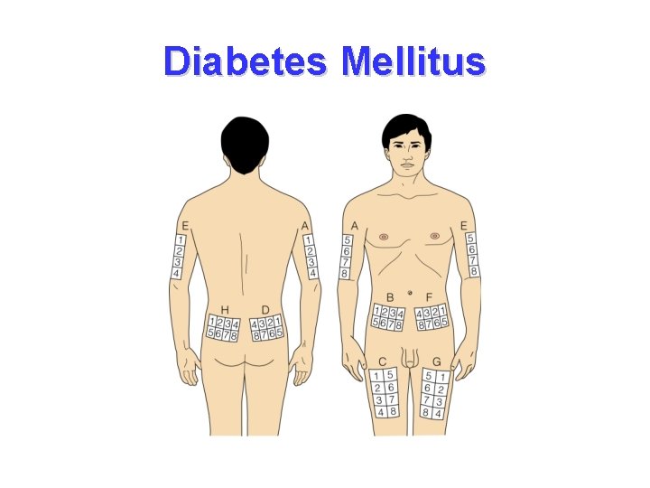 Diabetes Mellitus 