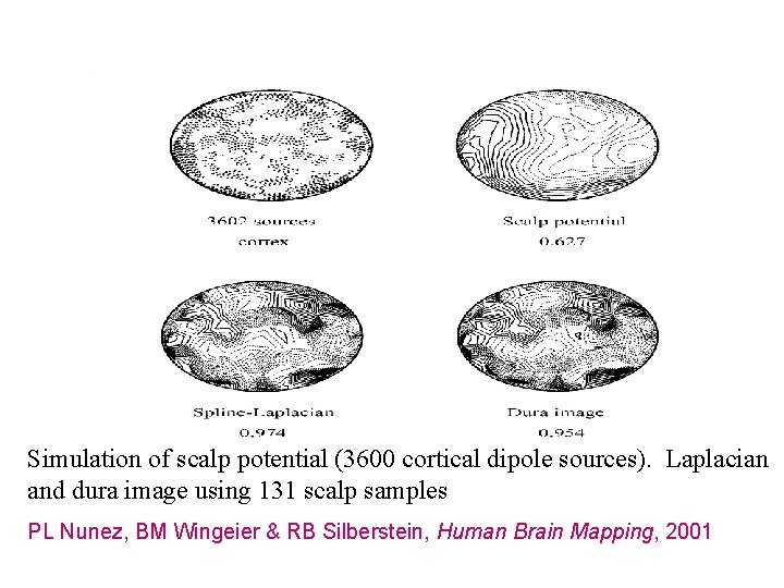 Simulation of scalp potential (3600 cortical dipole sources). Laplacian and dura image using 131