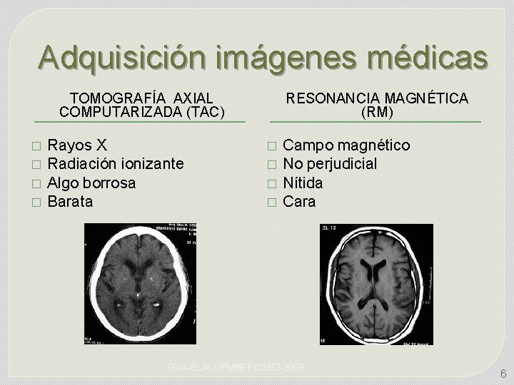 Adquisición imágenes médicas TOMOGRAFÍA AXIAL COMPUTARIZADA (TAC) � � Rayos X Radiación ionizante Algo