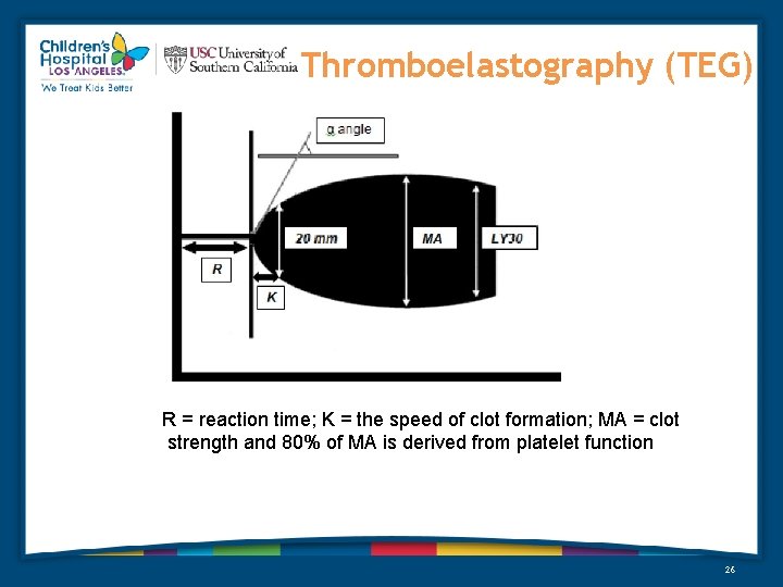 Thromboelastography (TEG) R = reaction time; K = the speed of clot formation; MA