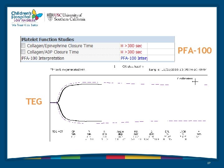 PFA-100 TEG 27 PFA-100 TEG 27