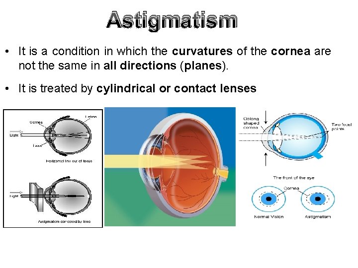 Astigmatism • It is a condition in which the curvatures of the cornea are