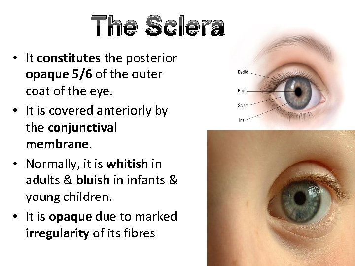 The Sclera • It constitutes the posterior opaque 5/6 of the outer coat of