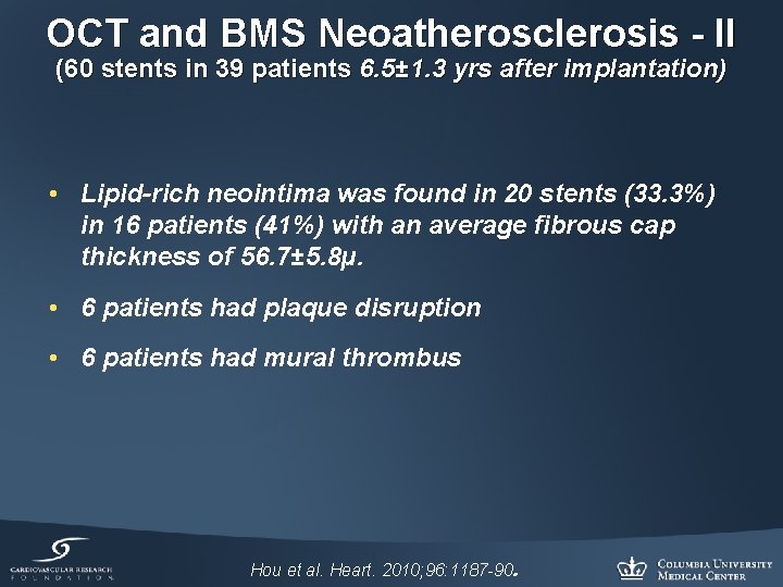 OCT and BMS Neoatherosclerosis - II (60 stents in 39 patients 6. 5± 1.