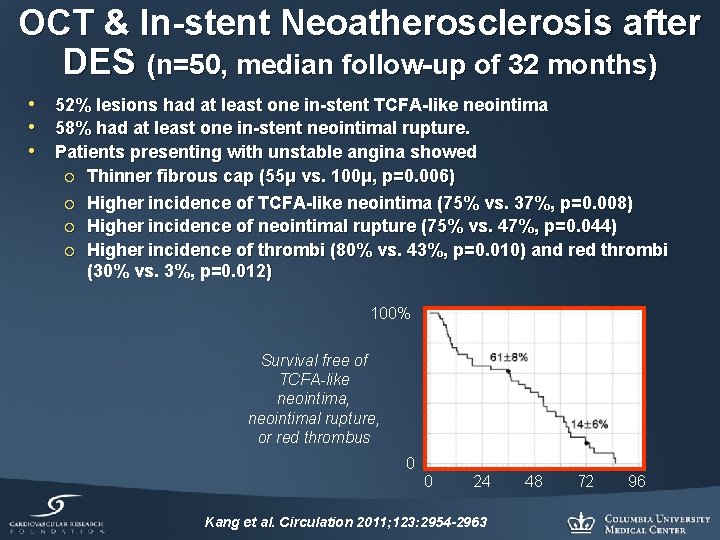 OCT & In-stent Neoatherosclerosis after DES (n=50, median follow-up of 32 months) • 52%