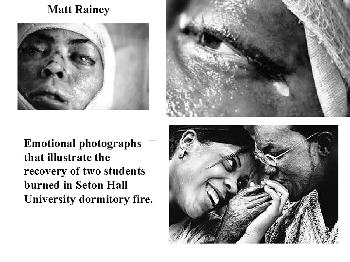 Matt Rainey Emotional photographs that illustrate the recovery of two students burned in Seton